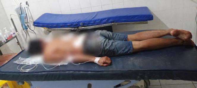 
					Pengeroyokan kuli bangunan di Kotabaru Semisir,korban mengalami luka luka. (SANAK.ID/RYAN WARDANI)